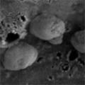 A high-powered black and white microscope image showing exosomes, nanosized parts of cells. (Credit: Surya Shrivastava / City of Hope